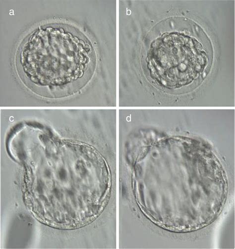 Blastocyst stage vitrification and re-expansion after warming. Human ...