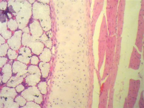 Compact Bone Histology Howmed Images