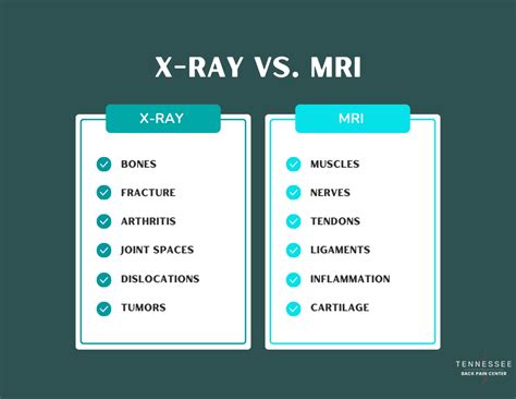 X-Ray vs. MRI: What Structures Can Be Seen?