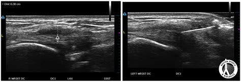 Boston Sports | The Role Of Regenerative Medicine In Orthopedics,…