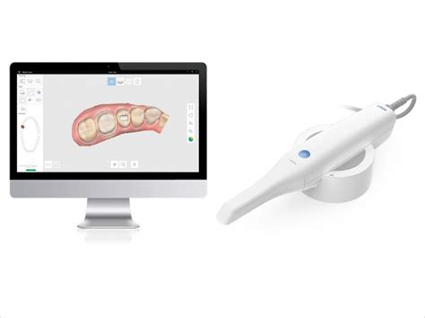 Medit And Straumann Ink Distribution Deal For Intraoral Scanners