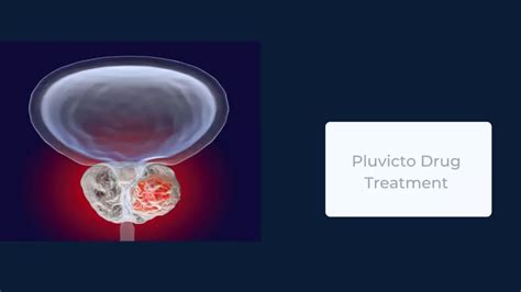 Pluvicto Cost In India | Cost & Treatment | Medsurge India