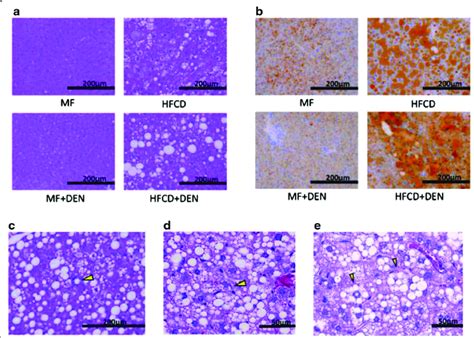 Representative Images Of Stained Liver Sections A 12 Weeks With