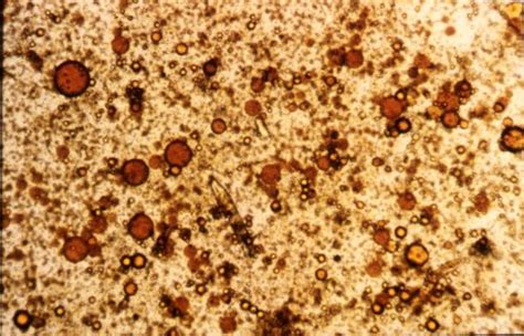 Pesquisa De Gordura Fecal - Fecal analysis: overview in Dogs (Canis) | Vetlexicon