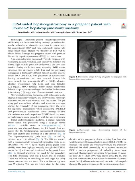 Pdf Eus Guided Hepaticogastrostomy In A Pregnant Patient With Roux En