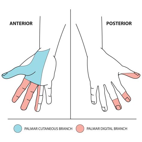 Upper Limb Nerve Lesions (Part 3 – The Median Nerve) - Medical Exam Prep