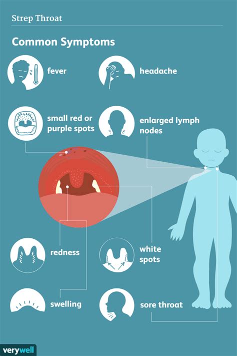 Strep Throat: Signs, Symptoms, and Complications