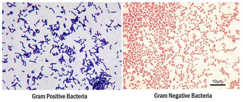 Metodo Colorazione di Gram | ProEko Srl