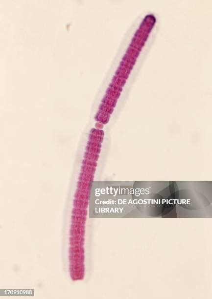 Cyanobacteria Microscope Photos and Premium High Res Pictures - Getty Images