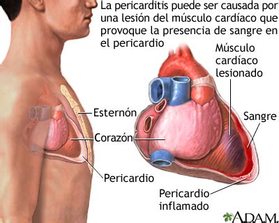 Punzadas En El Pecho Izquierdo Mujer Aboveidea