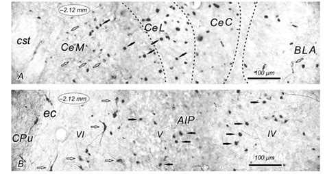 Photomicrographs Of Fos Immunoreactive Fos Ir And Nadph Diaphorase