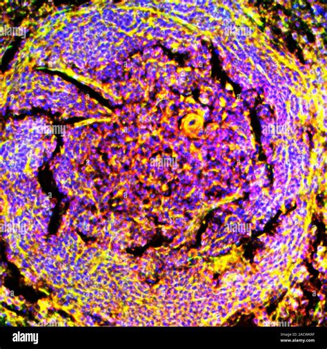 Spleen Tissue Fluorescence Deconvolution Micrograph Of A Section