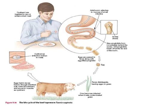 HELMINTHIASIS HELMINTHIC INFECTION