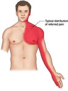 PULLED CHEST MUSCLE SYMPTOMS 5 - Muscle Pull | Muscle Pull