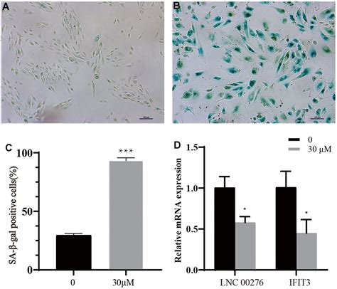 Identification Of Key Lncrnas In Age Related Macular Degeneration