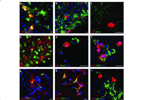 Microglia but not astrocytes or neurons are the primary source of IFNβ