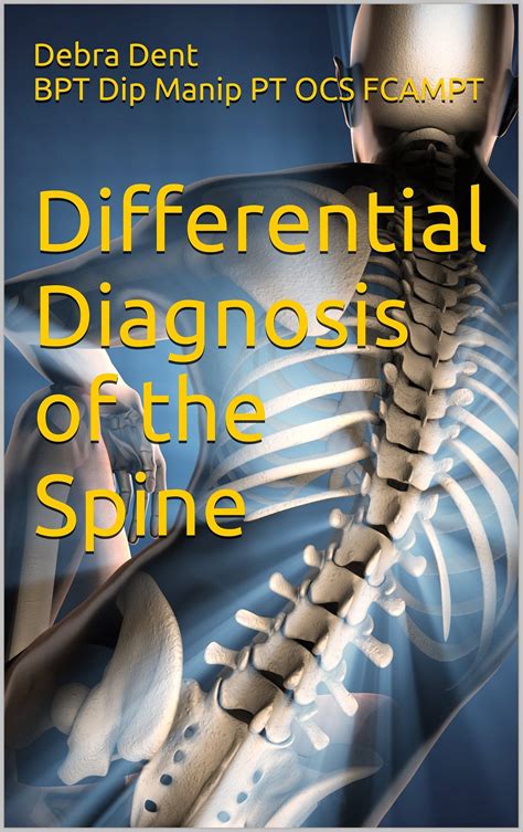 [READ]-Differential Diagnosis of the Spine: Exposing Spinal Pain ...