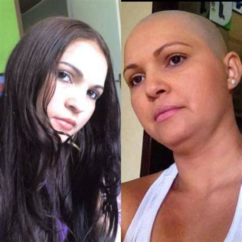 Pin by Kingmin on Before and after headshave | Shaved hair women ...