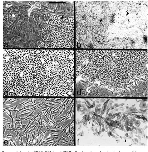 Figure From Human Sweat Gland Myoepithelial Cells Express A Unique