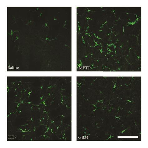 GFAP Positive Cells Specific Immunofluorescence Staining In The