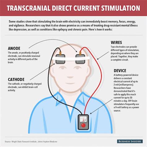 Transcranial Direct Current Stimulation 101 What Is Tdcs By