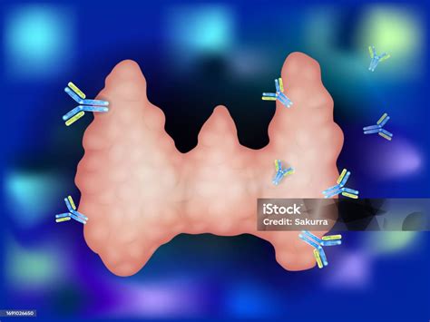 Ilustración De Ilustración Que Muestra Anticuerpos Atacando La Glándula