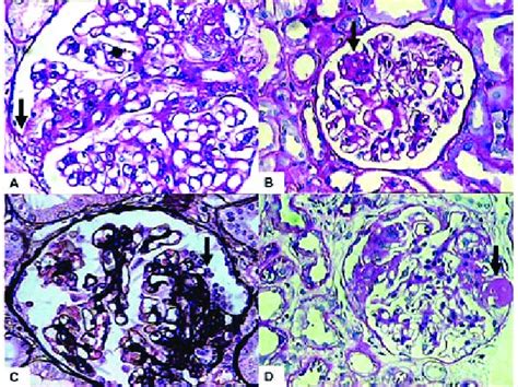 Defining Morphological Features Adapted For Segmental Download