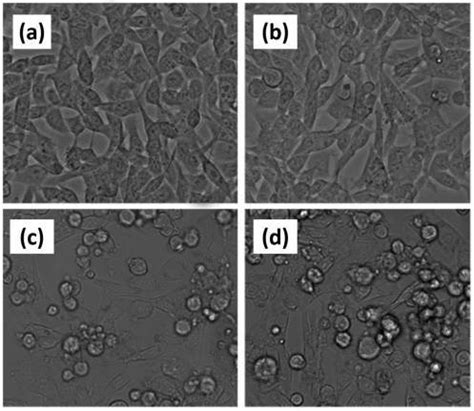 Optical Microscope Images Of Cytotoxicity Effect Observed At A Cell