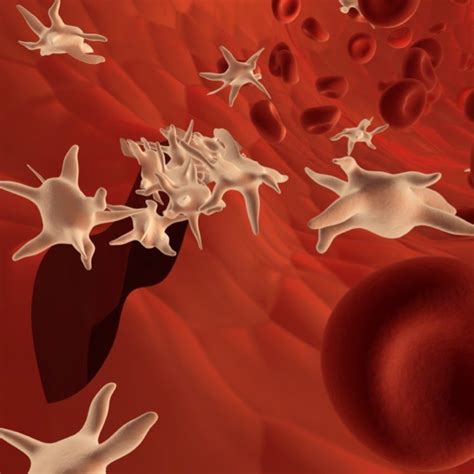 Podcast #150: Platelet Transfusion - The Emergency Medical Minute