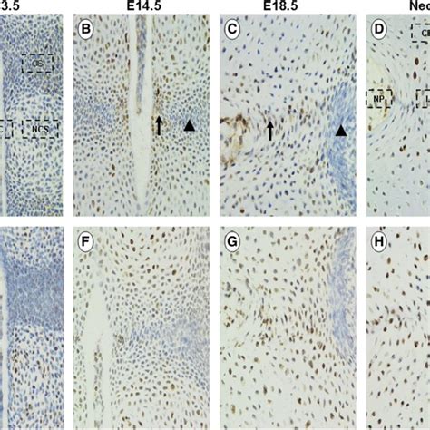 Immunohistochemical Staining Of Ki And Proliferating Cell Nuclear