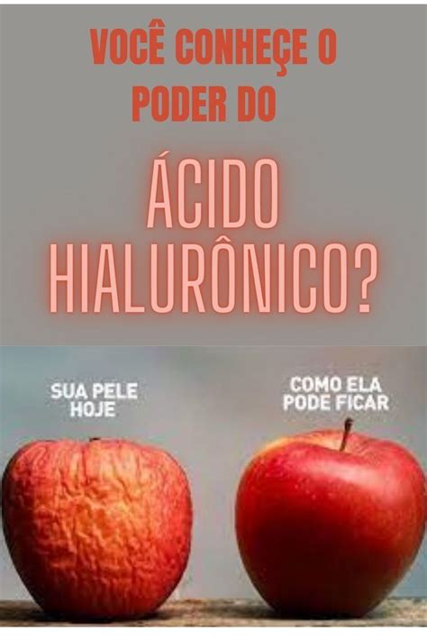 Já Ouviu Falar No ácido Hialurônico