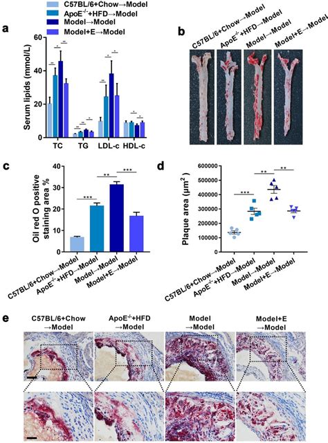 Plasma Lipid Levels And Atherosclerotic Lesions In Ovariectomized