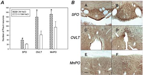 Brain Pattern Of Fos Ir In The Lamina Terminalis Nuclei After So A