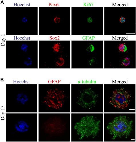 Frontiers A Custom Ultra Low Cost 3D Bioprinter Supports Cell Growth