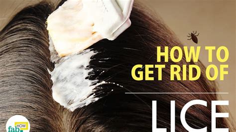 Will Relaxer Kill Head Lice Get Rid Of Hair Lice Permanently