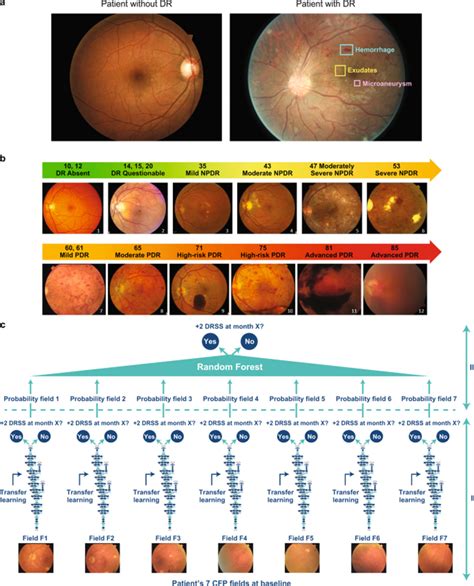 Diabetic Retinopathy Screening The Rise Of Artificial Intelligence In Healthcare