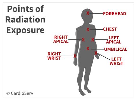 Sonographer Radiation Exposure You May Exceed Legally Mandated Limits Cardioserv