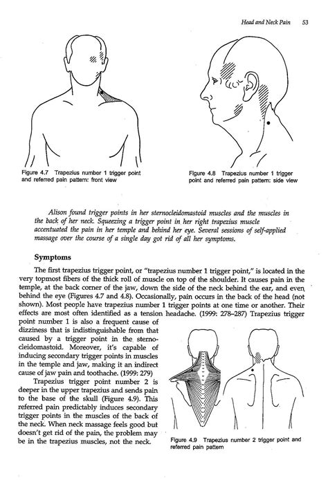 Trapezius pain? : r/TMJ