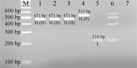 Agarose Gel Electrophoresis Of The One Step Multiplex Pcr Products