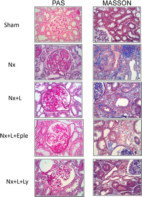 Representative Photomicrographs Of Pas Stained For Glomerulosclerosis