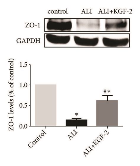 Western Blot Analysis Of Claudin 5 Zo 1 And Ve Cadherin Expression In