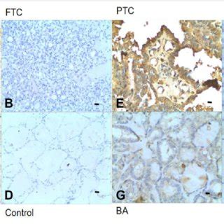 Expression Of Caveolin Protein In Ptc Ftc Ba And Control Groups A