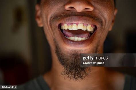 top  bottom teeth   premium high res pictures getty images