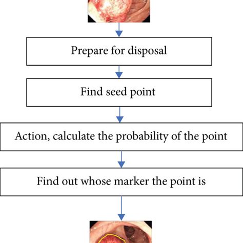 Image solution for colonoscopy polyps. | Download Scientific Diagram