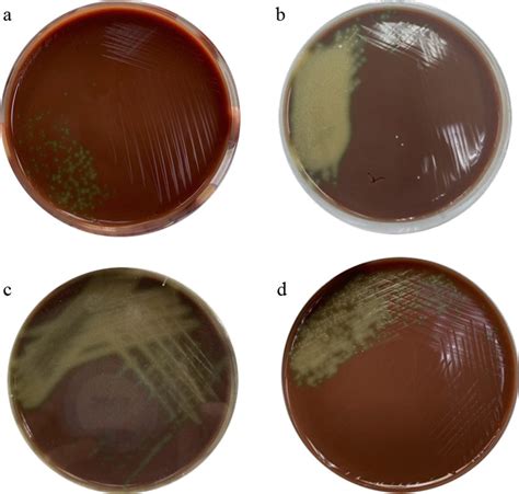 Blood Agar Plate Showing Colonies Obtained From A Peripheral Blood B