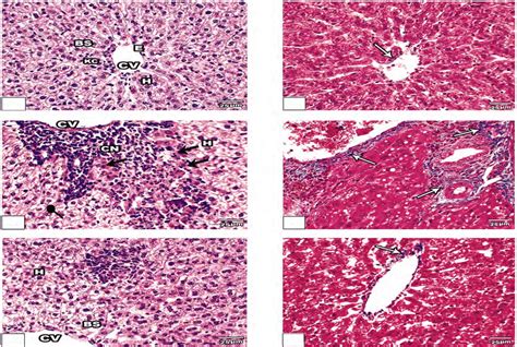 Photomicrograph Of Liver Tissues Stained With Hematoxylin And Eosin