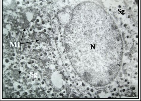 Electron Micrograph Of The Rabbit B Cell Showing Insulin Granules Sg