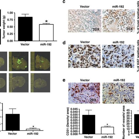 Expression Of MiR 192 Suppresses Liver Metastasis In An Orthotopic