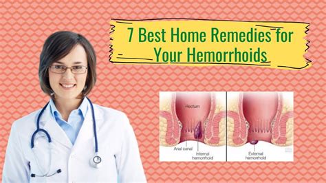 7 Best And Worst Home Remedies For Your Hemorrhoids Youtube