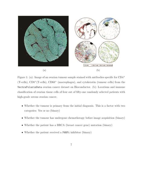 Analysing Spatial Point Patterns In Digital Pathology Immune Cells In